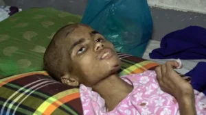 ঢাকায় গৃহকর্মী শিশুকে নির্যাতনের অভিযোগ, গুরুতর অবস্থায় হাসপাতালে তানিয়া